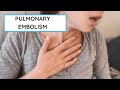 What is a Pulmonary Embolism?! | All you need to know
