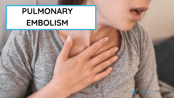 Where does your chest hurt with a blood clot? (2023)