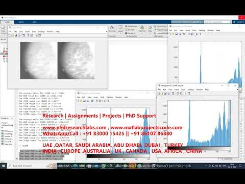 Contrast Limited Adaptive Histogram Equalization for mammography images MATLAB CLAHE code