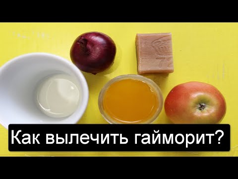 Как ВЫЛЕЧИТЬ гайморит без антибиотиков НАВСЕГДА?