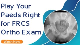 Play Your Paeds Right for FRCS Ortho  Exam | Orthopaedic Academy screenshot 4