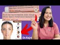 NG Glow Cream Review | NG Glow Cream For Melasma, Pigmentation & Dark spots in just under 250rs |