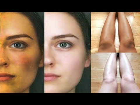 Get Fair Skin In Just 3 Days  Remove Sun Tan From Face & Body  Skin Whitening Home Remedies