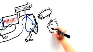 The Role of Inflammation in Dry Eye Understanding The Role Of Inflammation In Dry Eye