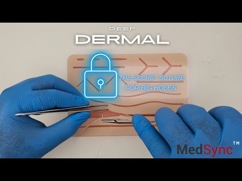 Deep Dermal Sutures: How Plastic Surgeons Close The BIGGEST HOLES