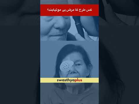 کس طرح کا مرض ہے موتیابند؟ | What is Cataract? | Cloudy/ Blurry Vision | Dr Zeeshan Rais Khan