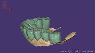 Exocad : Full anatomy Bridge Design