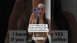 Do you want to date a woman like me? #accident #confidence #confidencewins