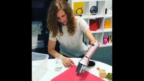 The Heartfelt Joy as AI Limbs Transform Lives! #ai #robotics #technology  #robot #ai  #aigpt #genai