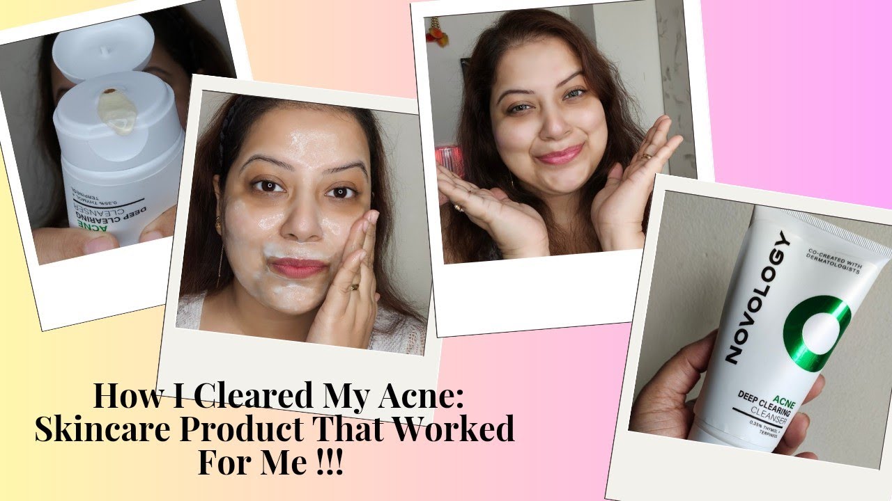 How I Cleared My Acne: Skincare Product That Worked For Me - YouTube