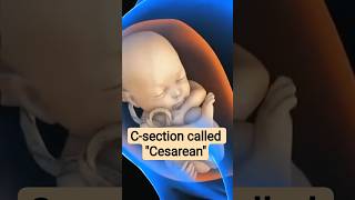 C-section called Cesarean In Real Life | Cesarean | BSc nursing | Midwifery |
