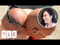 "You Have Got A Head Behind Your Head!" | Dr. Pimple Popper: Before The Pop