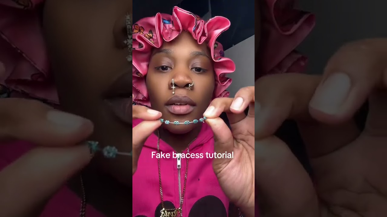 Do braces w me 🤷🏽‍♀️💕