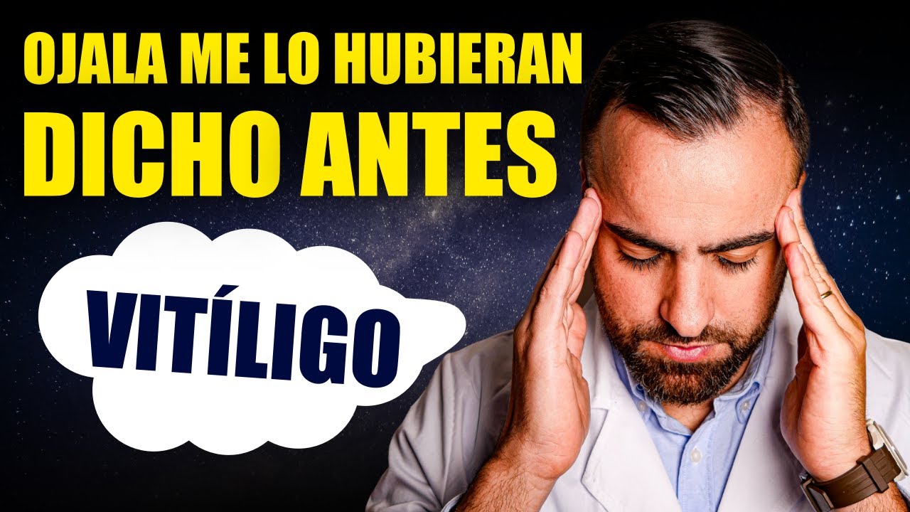 Lo que me Hubiera gustado SABER cuando me Diagnosticaron VITILIGO (y nadie me dijo)