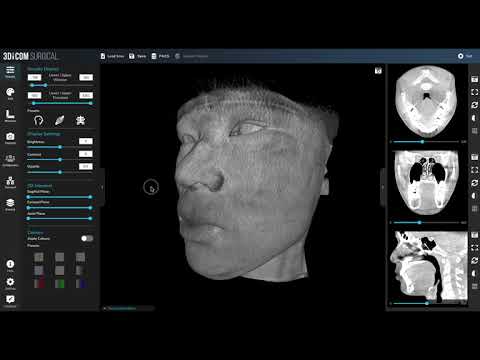 Virtually Cut Into Patients With 3Dicom Lite - Interactive 3D Dicom Viewer