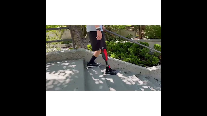 Utah Bionic Leg is Most Advanced Yet, Uses AI to Automatically Adapt to the Height of Steps