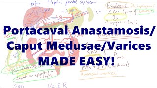 Portacaval Anastamosis/Caput Medusae/Varices MADE EASY! by Med Messy Notes  10,696 views 5 years ago 10 minutes, 23 seconds