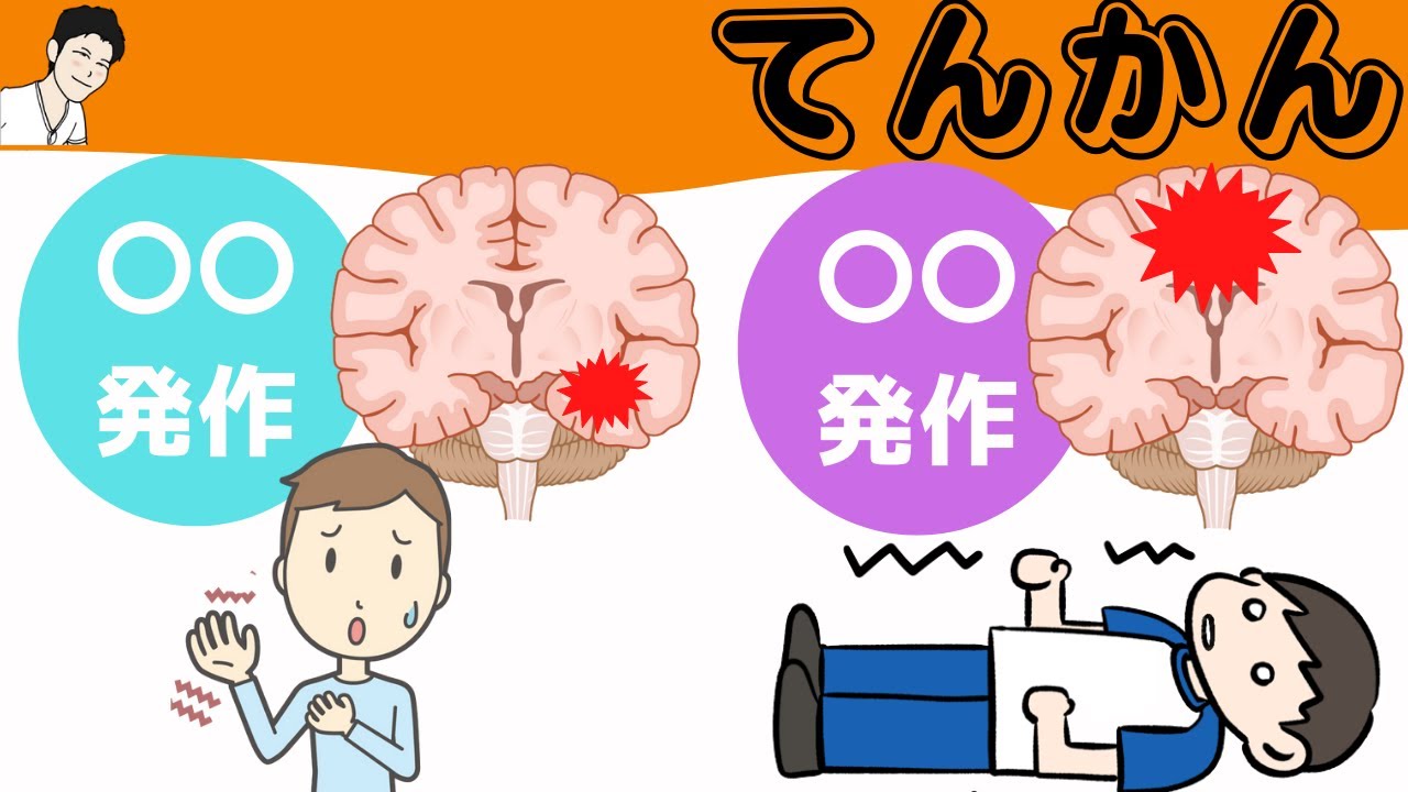 ⑦【てんかん】どんな種類があるか?治療薬は?まとめて解説(看護、薬学生向け) - YouTube