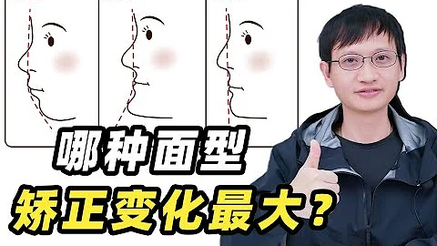 凹凸直你是哪種面型？改善程度主要取決於哪些方面？ - 天天要聞