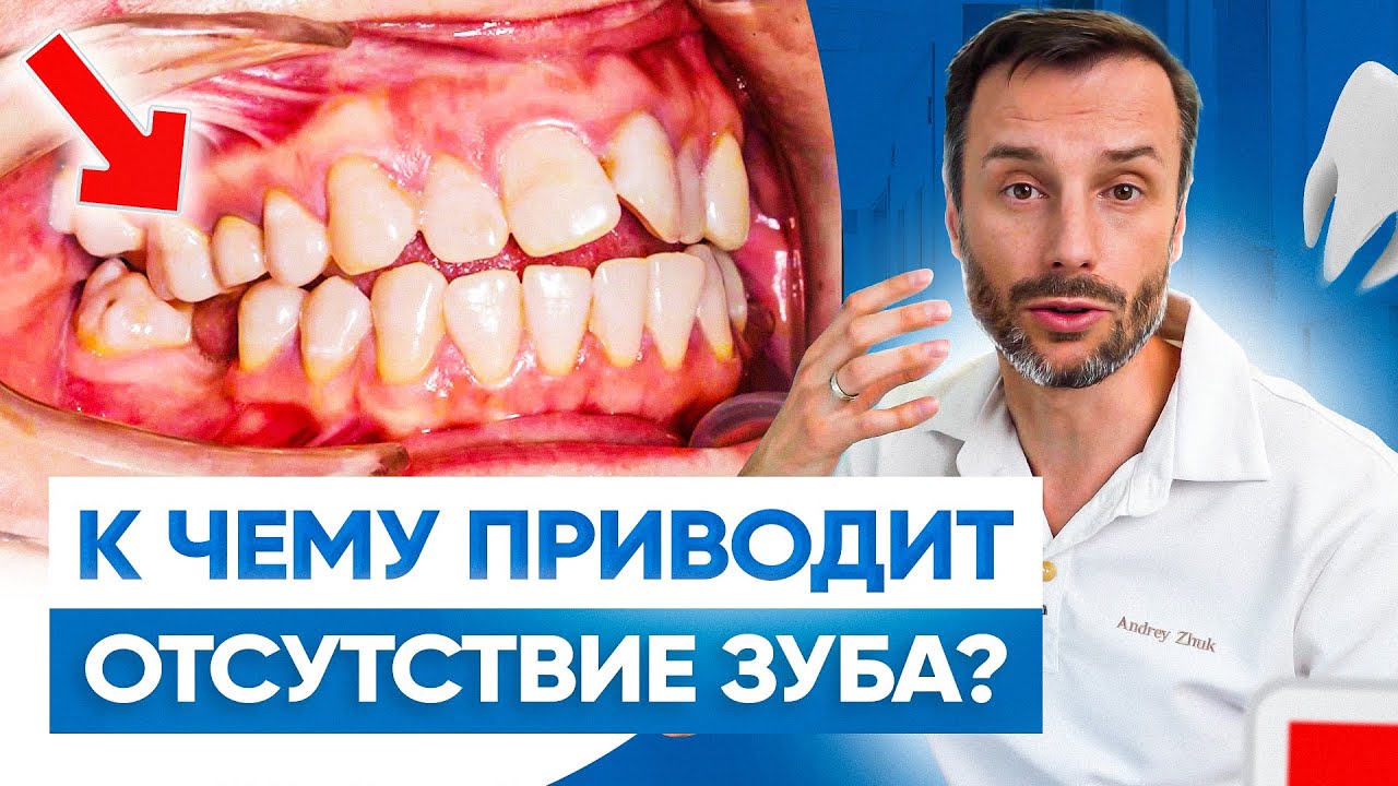 Что будет с вашей внешностью, если у вас нет зуба. Экспертное мнение ортодонта