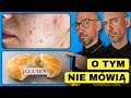 6 CHORÓB KTÓRE WYWOŁUJE GLUTEN O KTÓRYCH NIE MIAŁEŚ POJĘCIA!