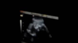 MOV02981