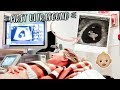 FIRST PREGNANCY ULTRASOUND + HEARING BABY'S HEARTBEAT!