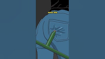 Impaled By A Christmas Tree 😮🎄