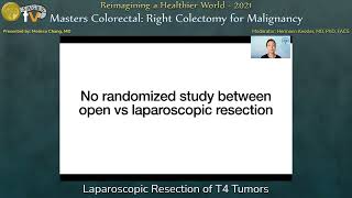 Laparoscopic Resection of T4 Tumors