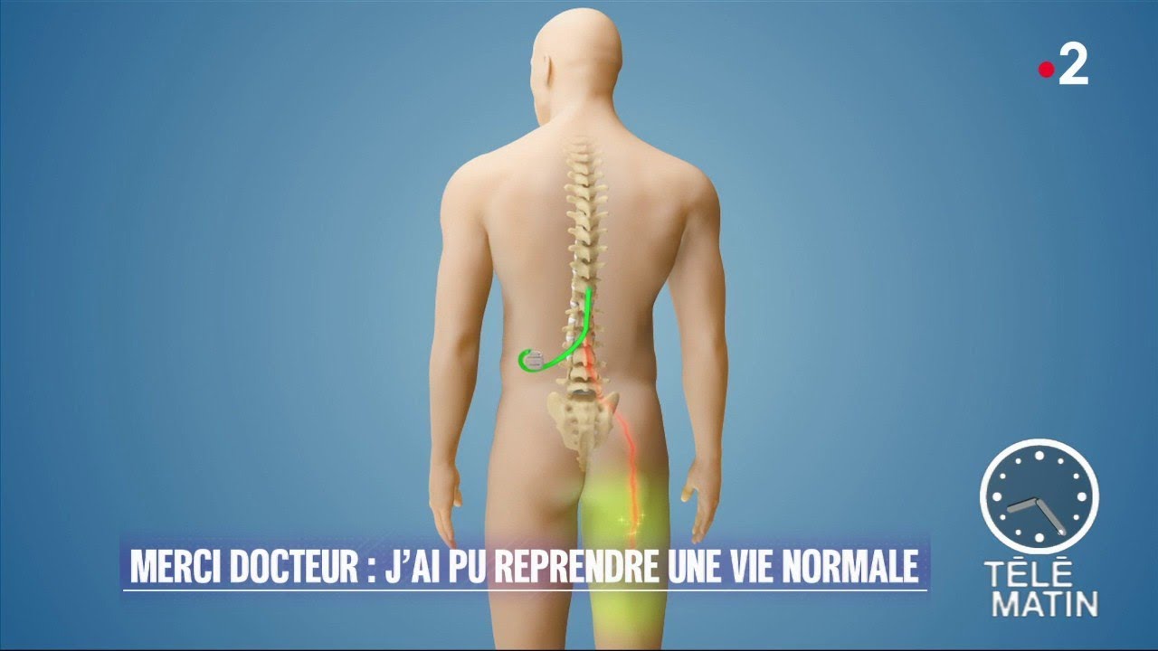 Santé - Merci docteur : « Grace à l’implantation d’un stimulateur antidouleur, je revis »
