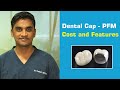 PFM Dental Cap -Advantages/Disadvantages & Cost