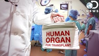 Why Do Organ Transplants Fail So Often? Why Do Organ Transplants Fail So Often?