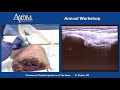 Ultrasound-Guided Knee Joint &amp; Medial Meniscus Injection | Cadaver Training with Dr. Brian Shiple