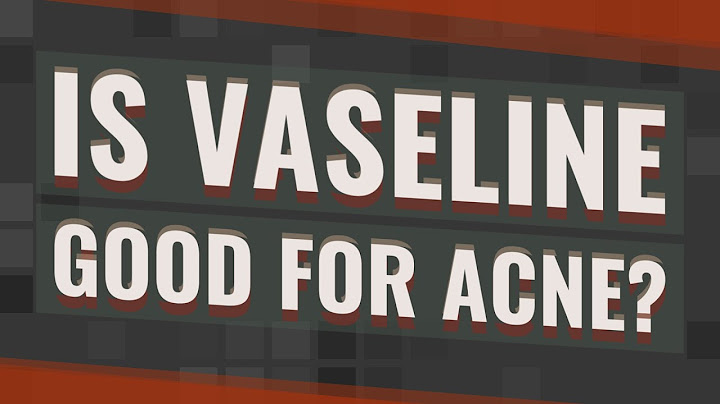 Is vaseline good for acne prone skin