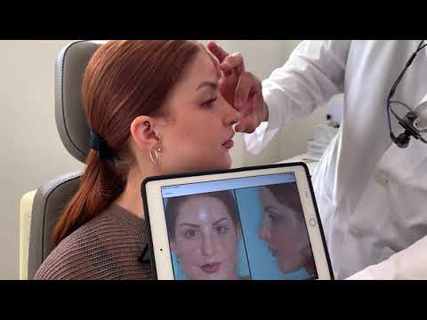 Video thumbnail: Achieve an Elegant Nose with Finesse Tip Rhinoplasty | Dr. Anthony Bared, MD, FACS Miami, FL · Dr. Anthony Bared, M.D - Facial Plastic Surgeon