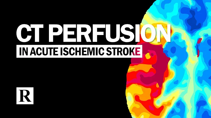 Perfusion CT: Évaluation de la perfusion sanguine dans le cerveau