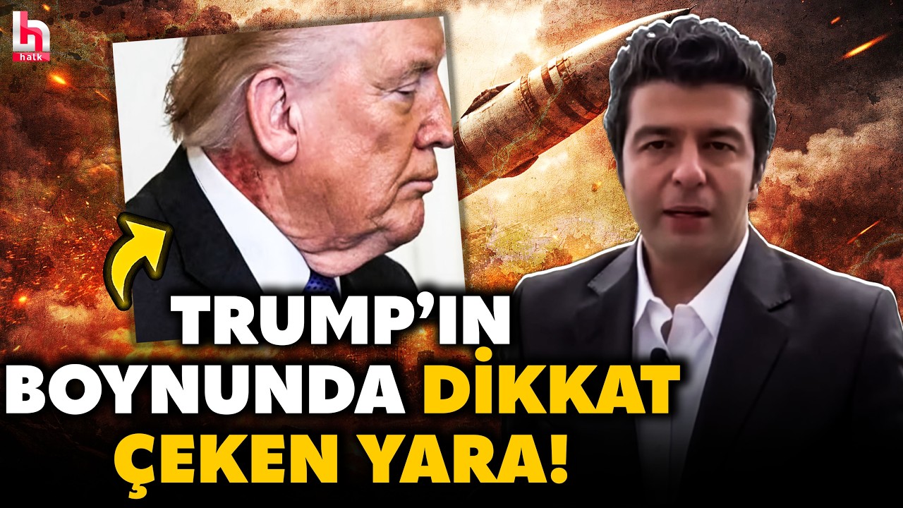 TRUMP'IN BOYNUNDAKİ YARA DİKKAT ÇEKTİ! ABD bu iddialarla çalkalanıyor! Hüseyin Günay aktardı!