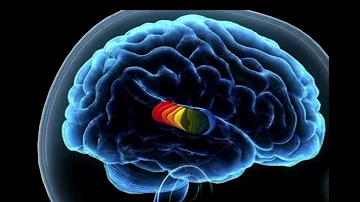 ¿Qué parte del cerebro afecta al tinnitus?