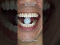 Satisfying Chewing ASMR #Compilation #ASMR #DoctorTristanPeh