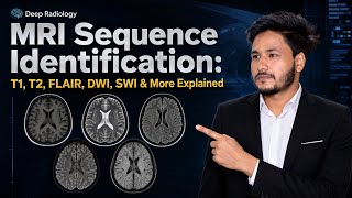 MRI Sequence Identification: T1, T2, FLAIR, DWI, SWI & More Explained screenshot 4