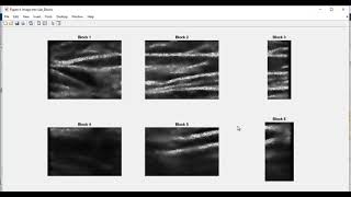 Ultrasound based Venipuncture Needle Insertion Matlab Simulation | Intelligent Ultrasound Prediction screenshot 2