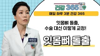 [건강365] 잇몸뼈 돌출, 수술 대신 이렇게 교정! l 뉴욕스마일치과 l 051-702-6677