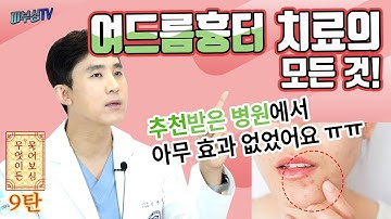 여드름흉터 치료에 대한 모든 것을 알려드림! [피부과전문의 피부심]