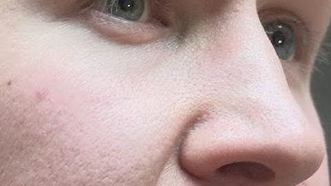 How To Generate Nasal Resonance When Singing