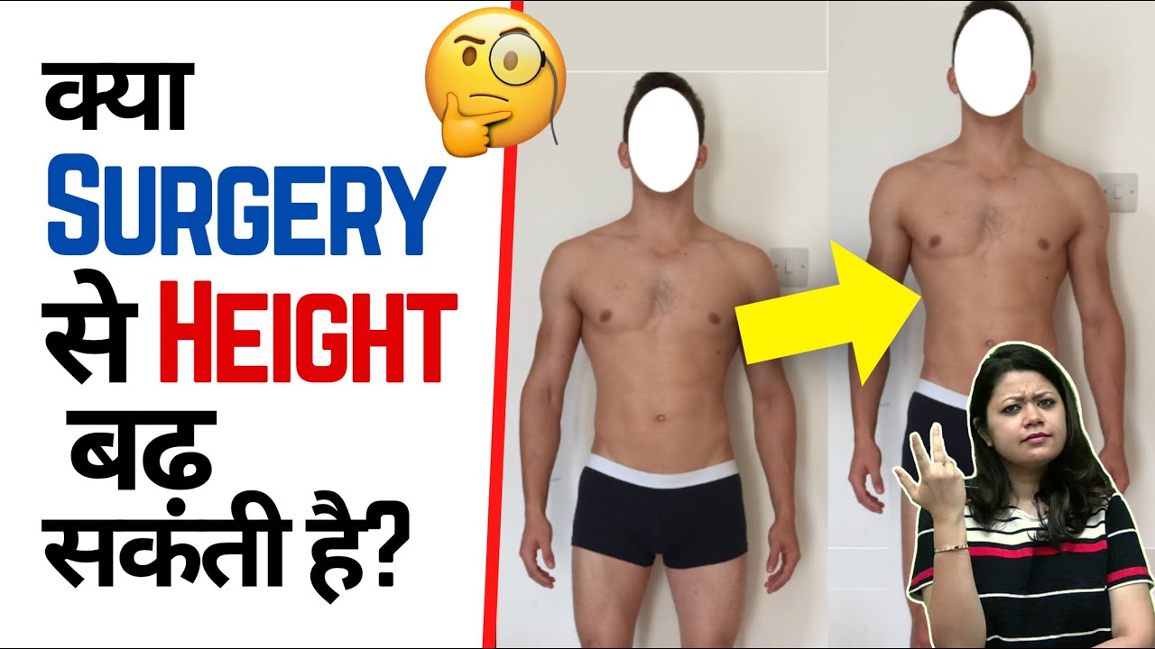 क्या Surgery से 🙋🏻‍♂️ Height बढ़ सकती है? 🤔 | Factovation | Purnima Kaul #shorts