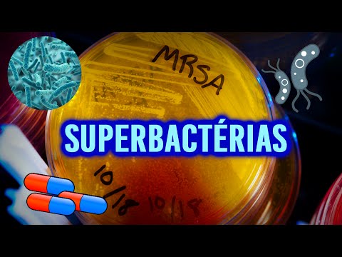 Vídeo: Para 2050, Las Superbacterias Matarán A 10 Millones De Personas Al Año - Vista Alternativa