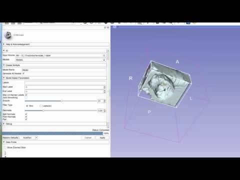 Three-dimensional printing of echocardiography data sets