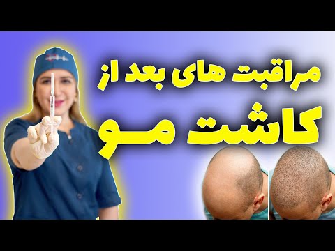 مراقبت بعد از کاشت مو چیست آیا ریزش مو بعد کاشت طبیعی است کدامیک از عوارض کاشت مو خطرناک است
