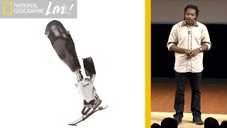Making Artificial Limbs More Comfortable | Nat Geo Live