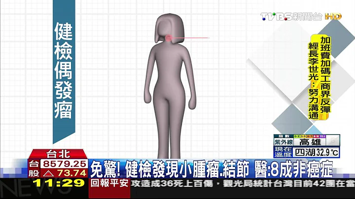 【TVBS】免驚！健檢發現小腫瘤、結節　醫：8成非癌症 - 天天要聞